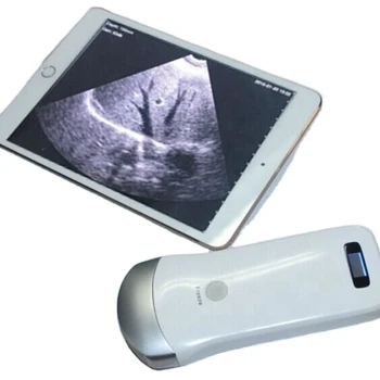 Lekárske Ultrazvukové Kontroly Prenosných Bezdrôtových Zariadení Ultrazvukové Sondy